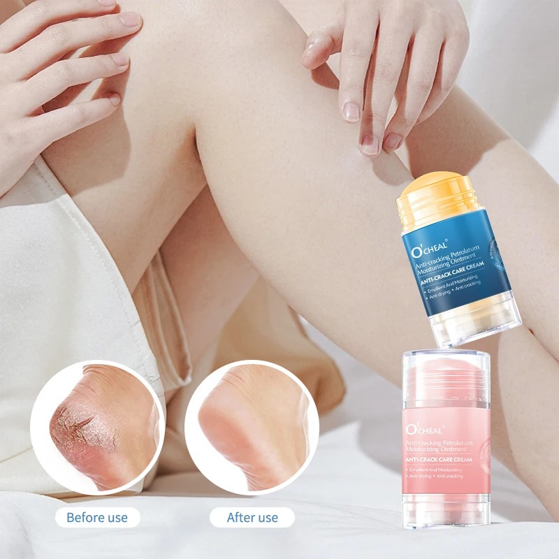 Anti Crack Foot Cream For Dry  - Heels ulasan dan harga